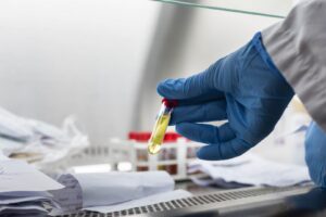 Αυξημένη η δραστηριότητα της γρίπης, μείωση παρουσιάζουν οι δείκτες για κορωνοϊό