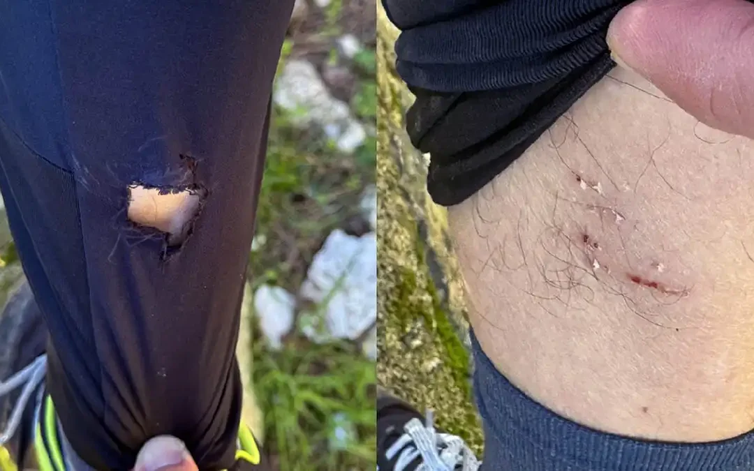 Καταγγελία για επίθεση σκυλιών σε δρομείς στο δάσος Φρόντζου