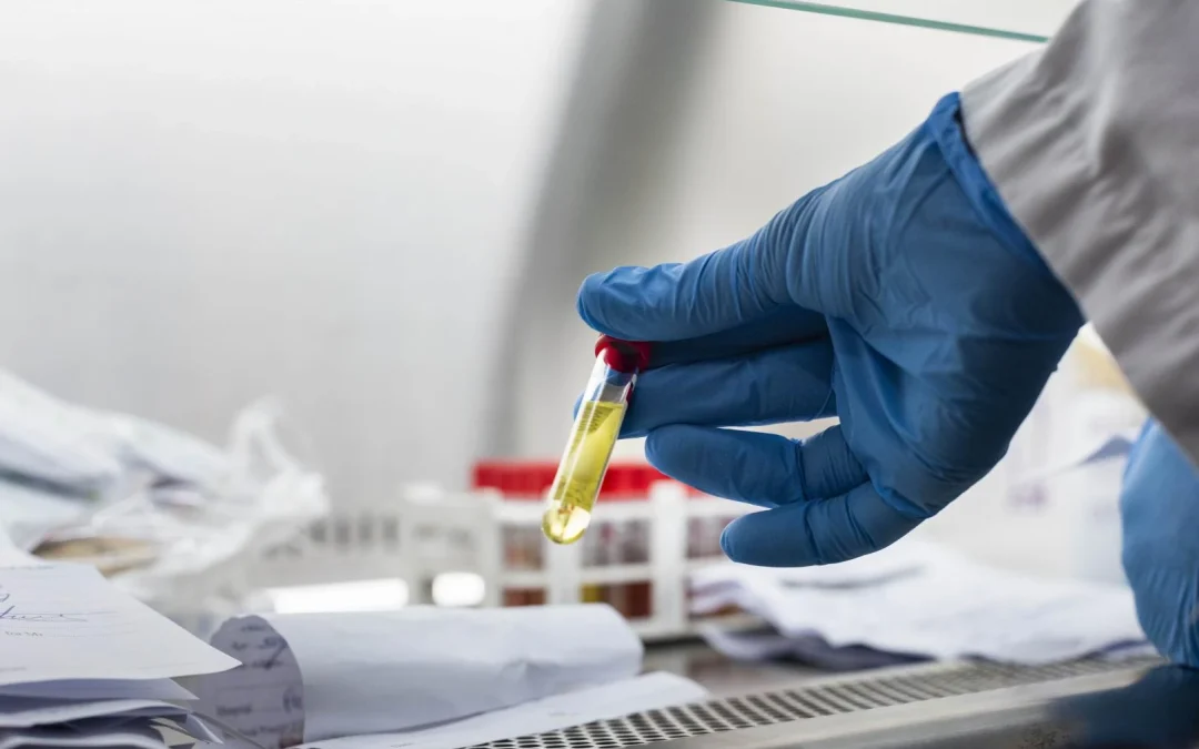 ΕΟΔΥ: Νέος μηχανισμός επιδημιολογικής επιτήρησης με ψηφιακά εργαλεία για έγκαιρη ανίχνευση λοιμώξεων