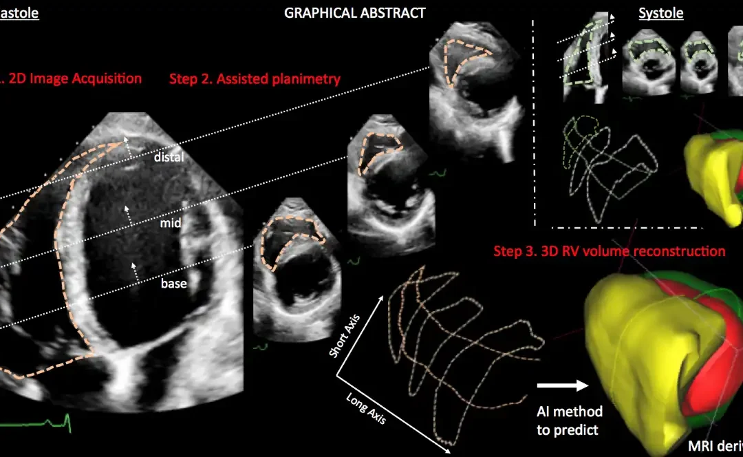 Τεχνητή Νοημοσύνη: Λογισμικό Ελλήνων επιστημόνων ανιχνεύει καρδιακά προβλήματα